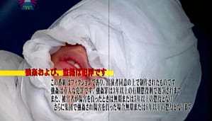 実験体モルモット患者を完全拘束マミフィケーションで犯す